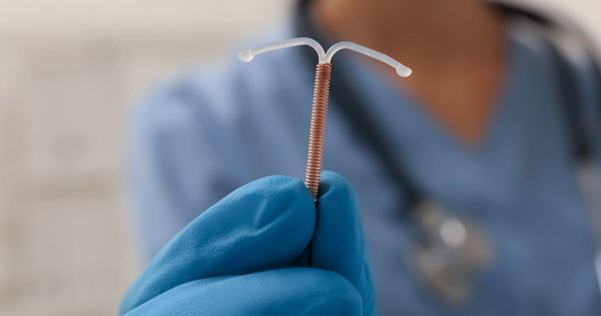 Santé reproductive : le stérilet Jaydess et son lien inquiétant avec les grossesses extra-utérines