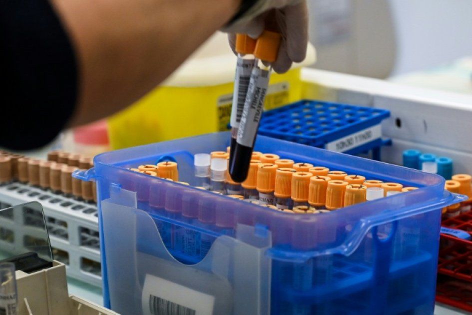 Tests ADN en libre accès : une question délicate sur la légalisation en France