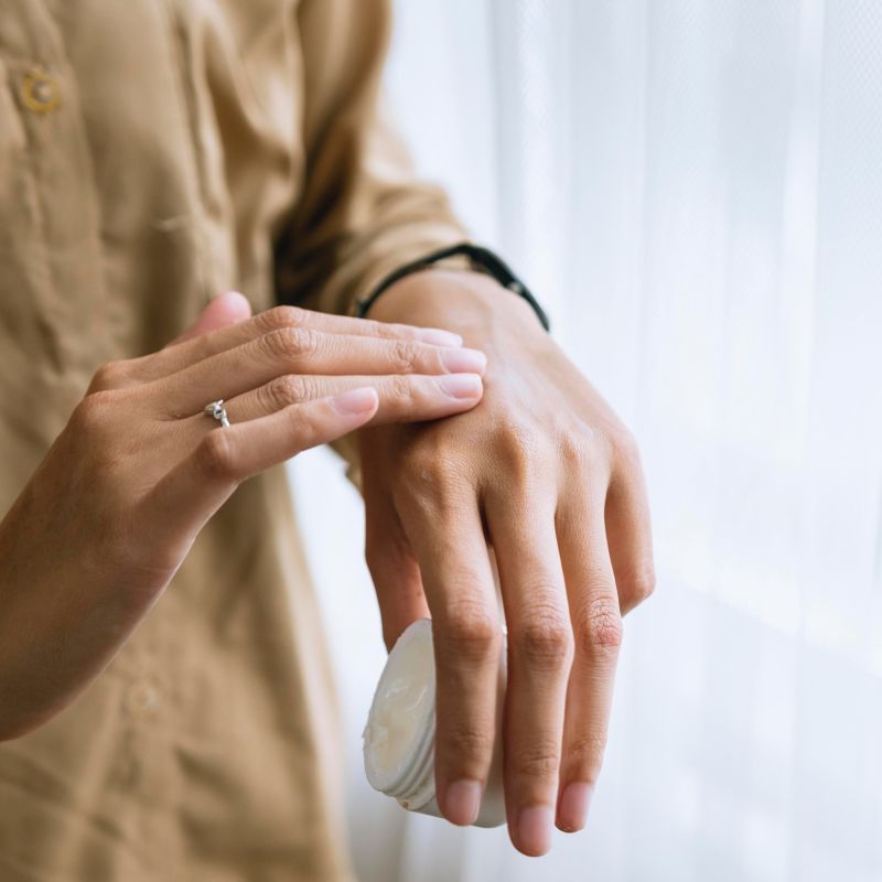 Réagir rapidement face à une brûlure : les conseils essentiels